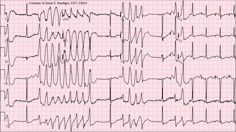Course Image