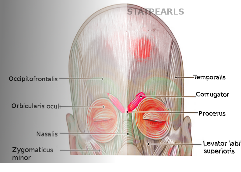 Corrugator muscle