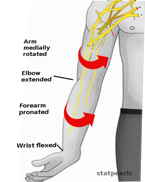 Erb palsy-Physical exam