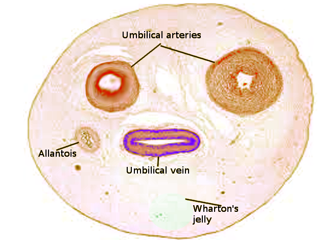 <p>Umbilical Cord