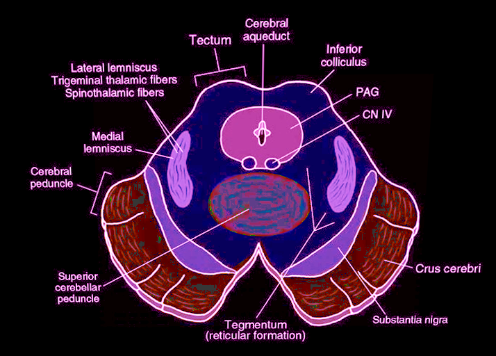 <p>Midbrain, Cross-Sectional Anatomy