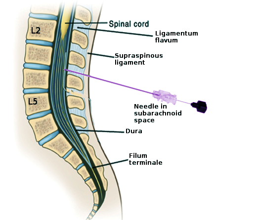 <p>Distal Lumbar Spine Anatomy&nbsp;</p>