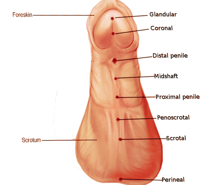 Location of hypospadias