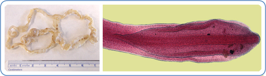 <p><em>Diphyllobothrium latus</em>&nbsp;Tapeworm