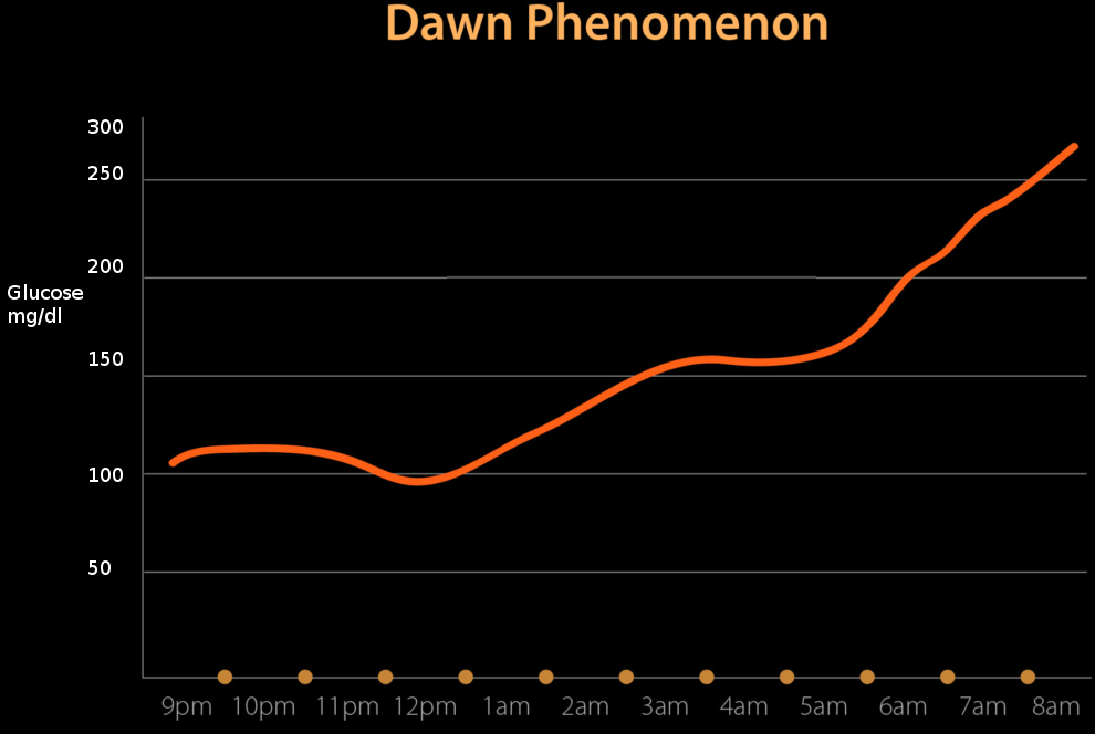 Dawn phenomenon