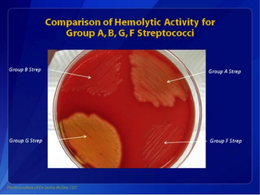 <p>Comparisons of Hemolytic Activity for Groups A, B, G, and F Streptococci