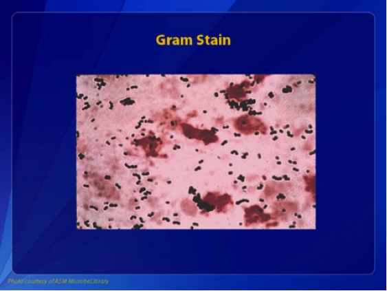 <p>Group B Streptococcus, Gram Stain