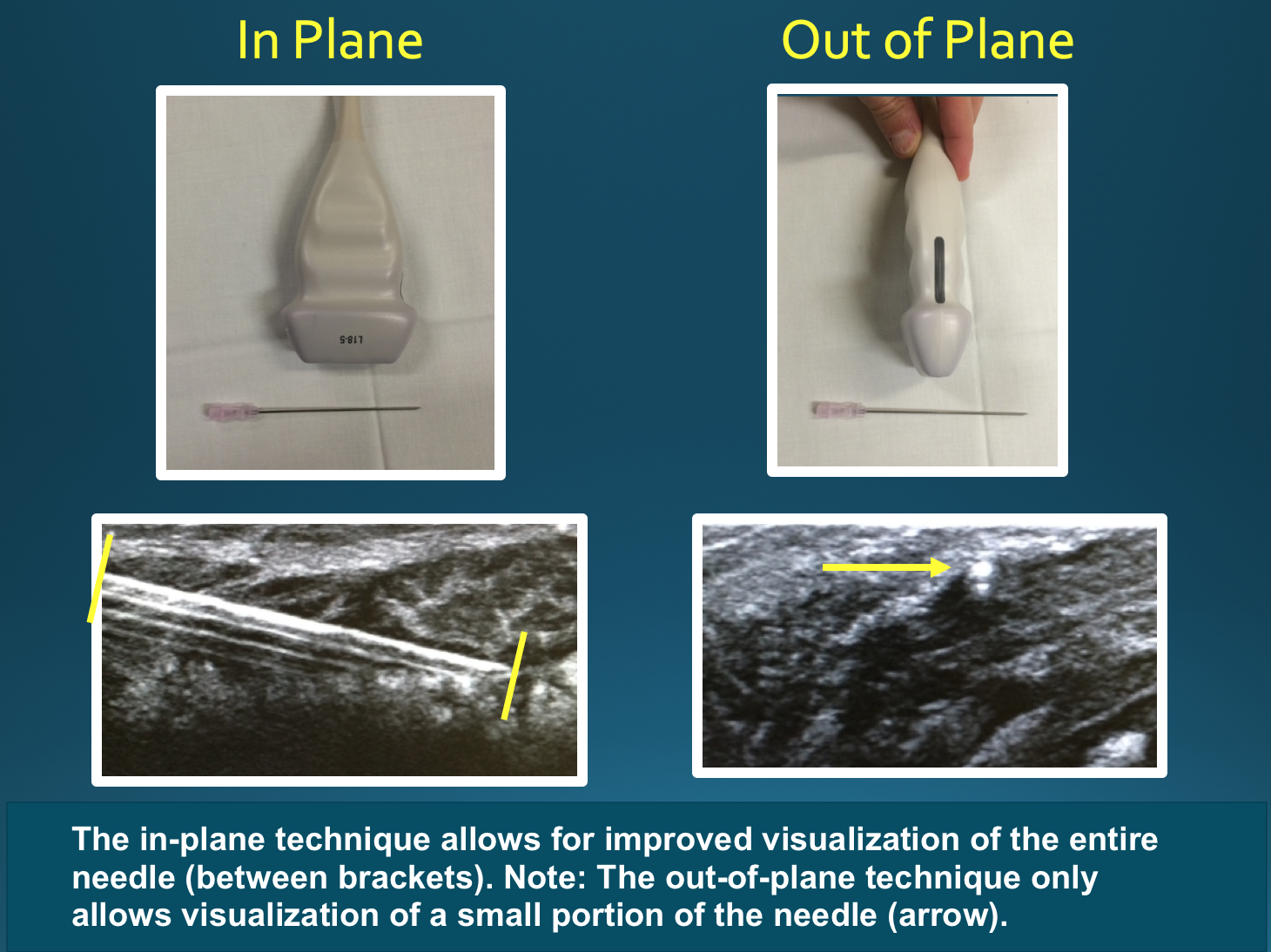 <p>Ultrasound&nbsp;Techniques.&nbsp;</p>