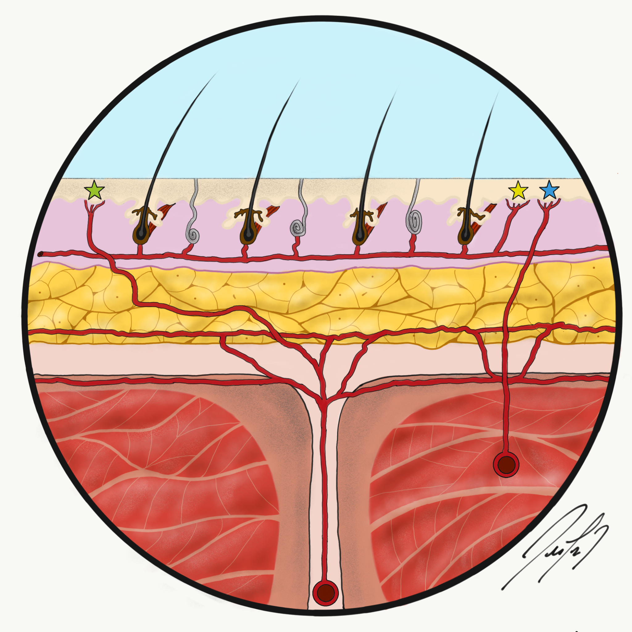 <p>Fasciocutaneous Flap Perfusion