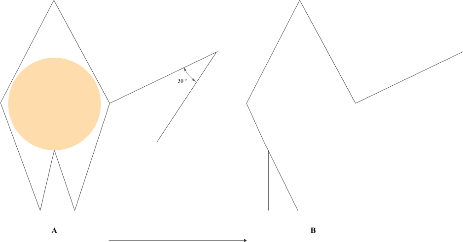 <p>Webster Rhombic Flap Modification