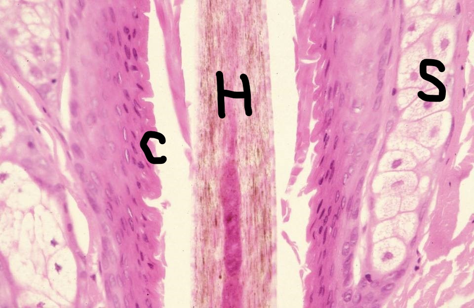 Pilosebaceous unit