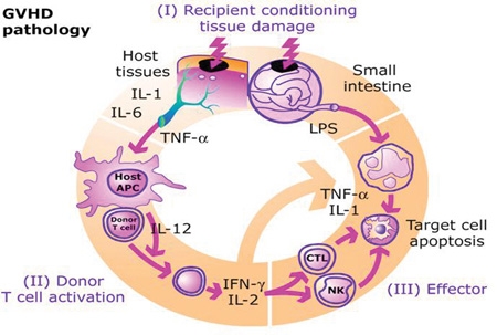 <p>GVHD Pathogenesis&nbsp;</p>