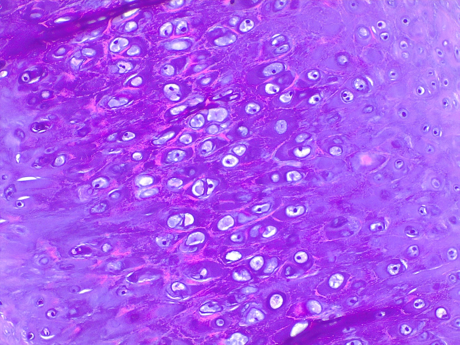 <p>Cartilage. H/E 20&times; magnification.</p>