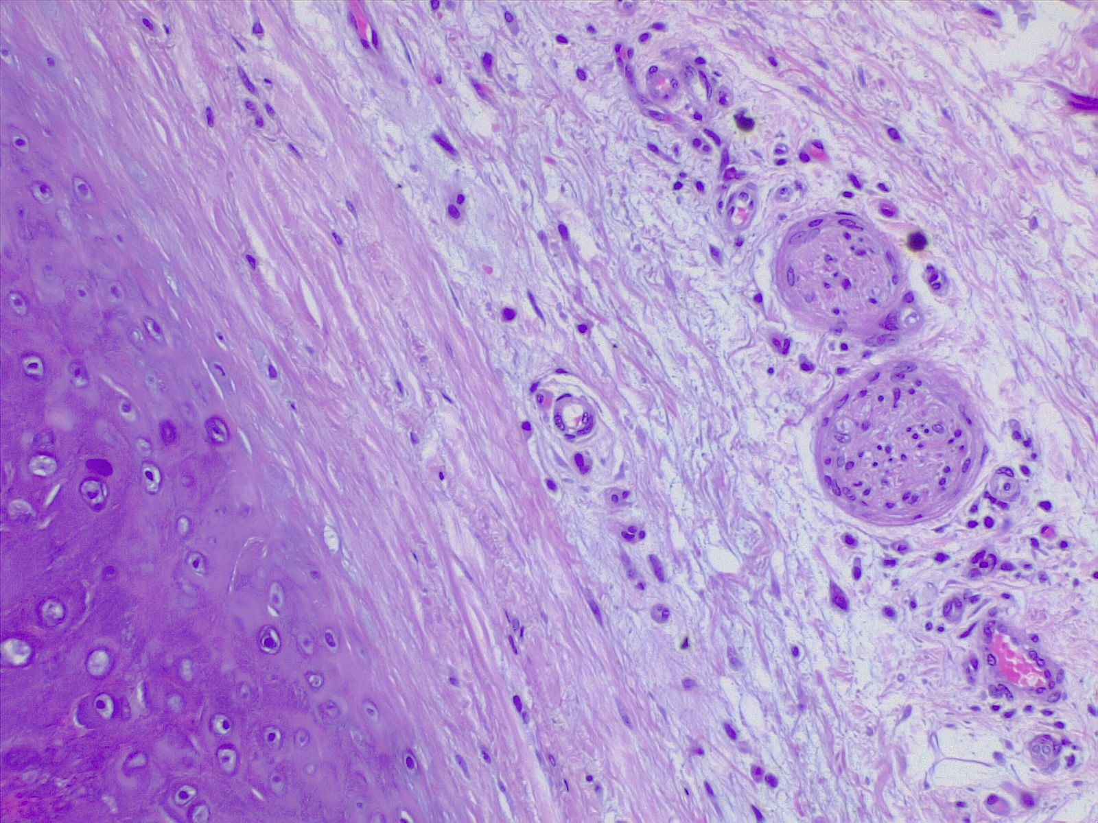 <p>Cartilage and Nerves. H/E 4&times; magnification.</p>