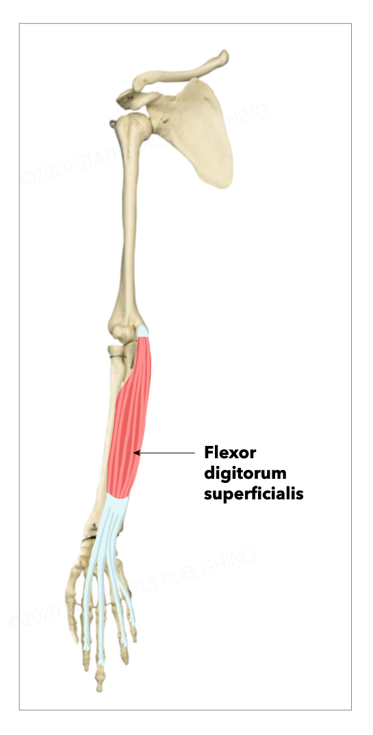 <p>Flexor Digitorum Superficialis</p>