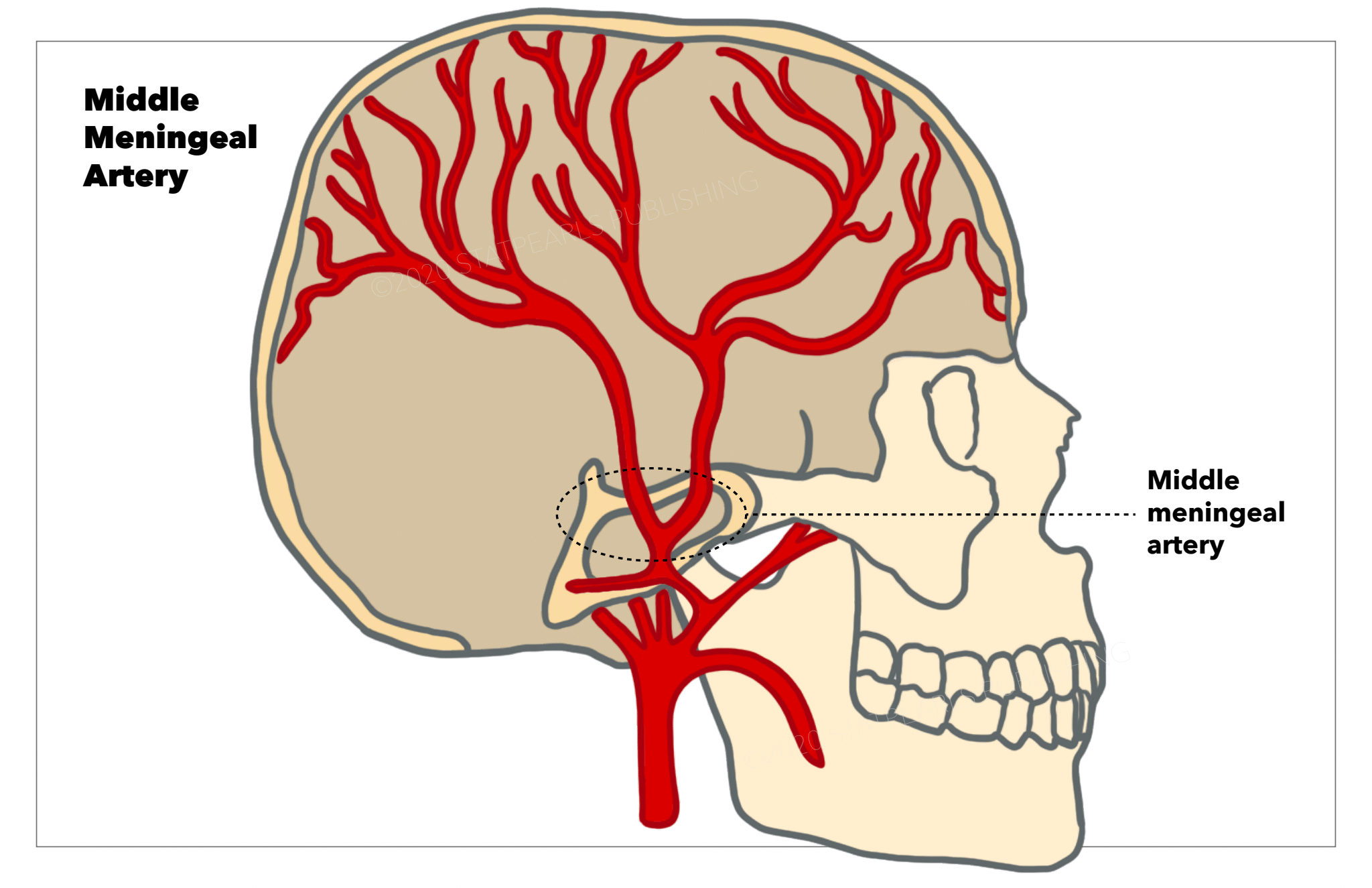 <p>Middle Meningeal Artery. This illustration portrays the middle meningeal artery in red.</p>