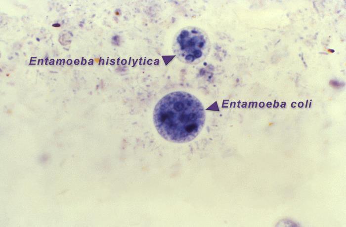 <p>Amoebic Organisms in&nbsp;the Cystic Stages of Development