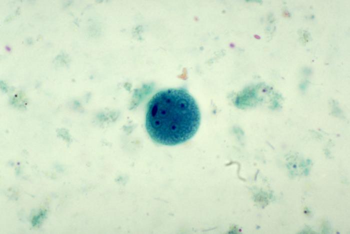 <p>Mature <em>Entamoeba coli</em> Cyst