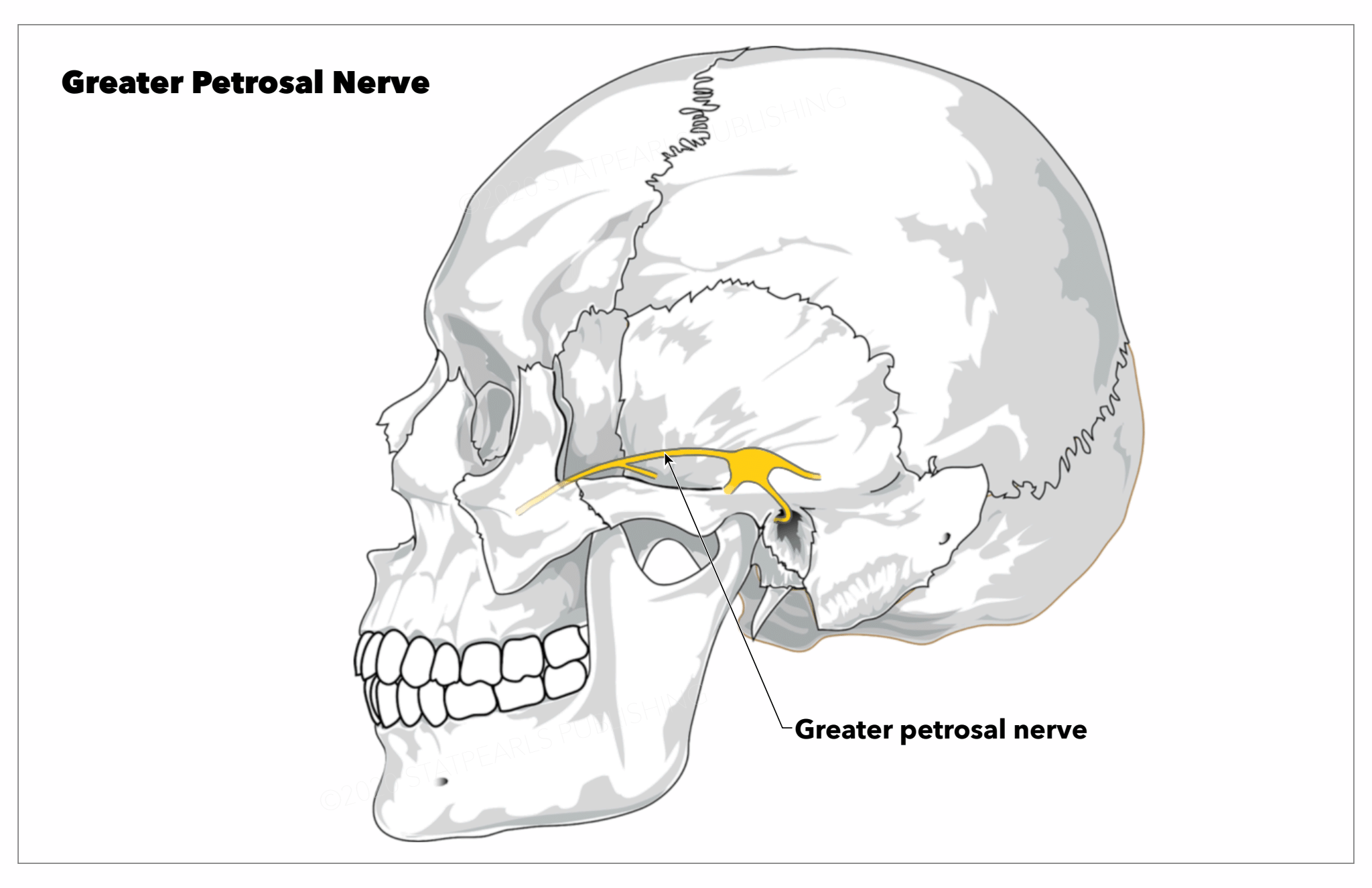 <p>Greater Petrosal Nerve. This image shows the greater petrosal nerve's course within the craniofacial region.</p>