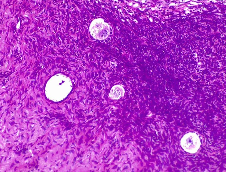 <p>Ovarian Follicle Development: Oocytes and Primary Follicles in Early Stages