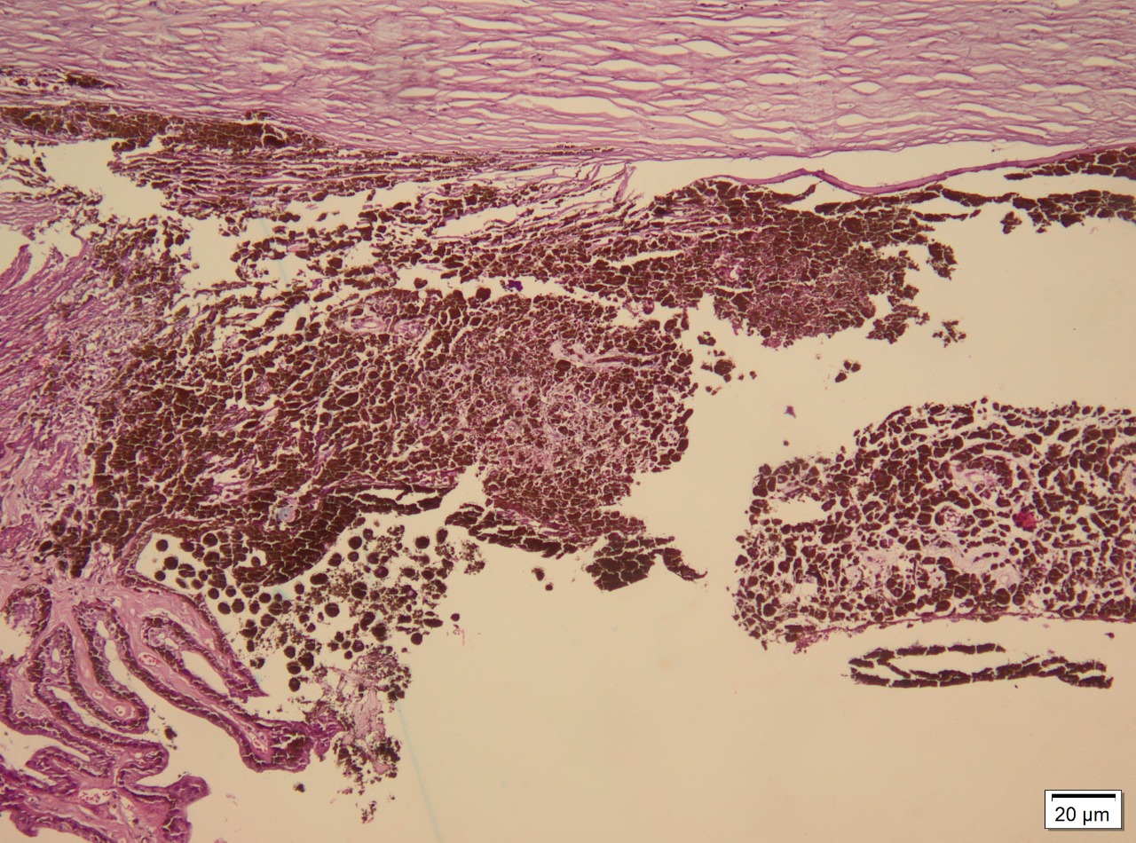 <p>Immunohistochemical Staining