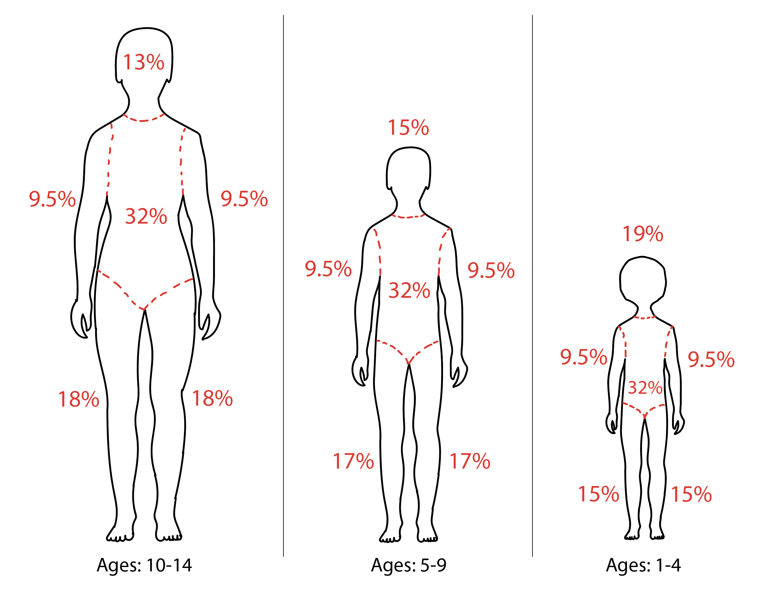 <p>Diagram of Rule of 9s Modifications for Pediatric Patients.</p>