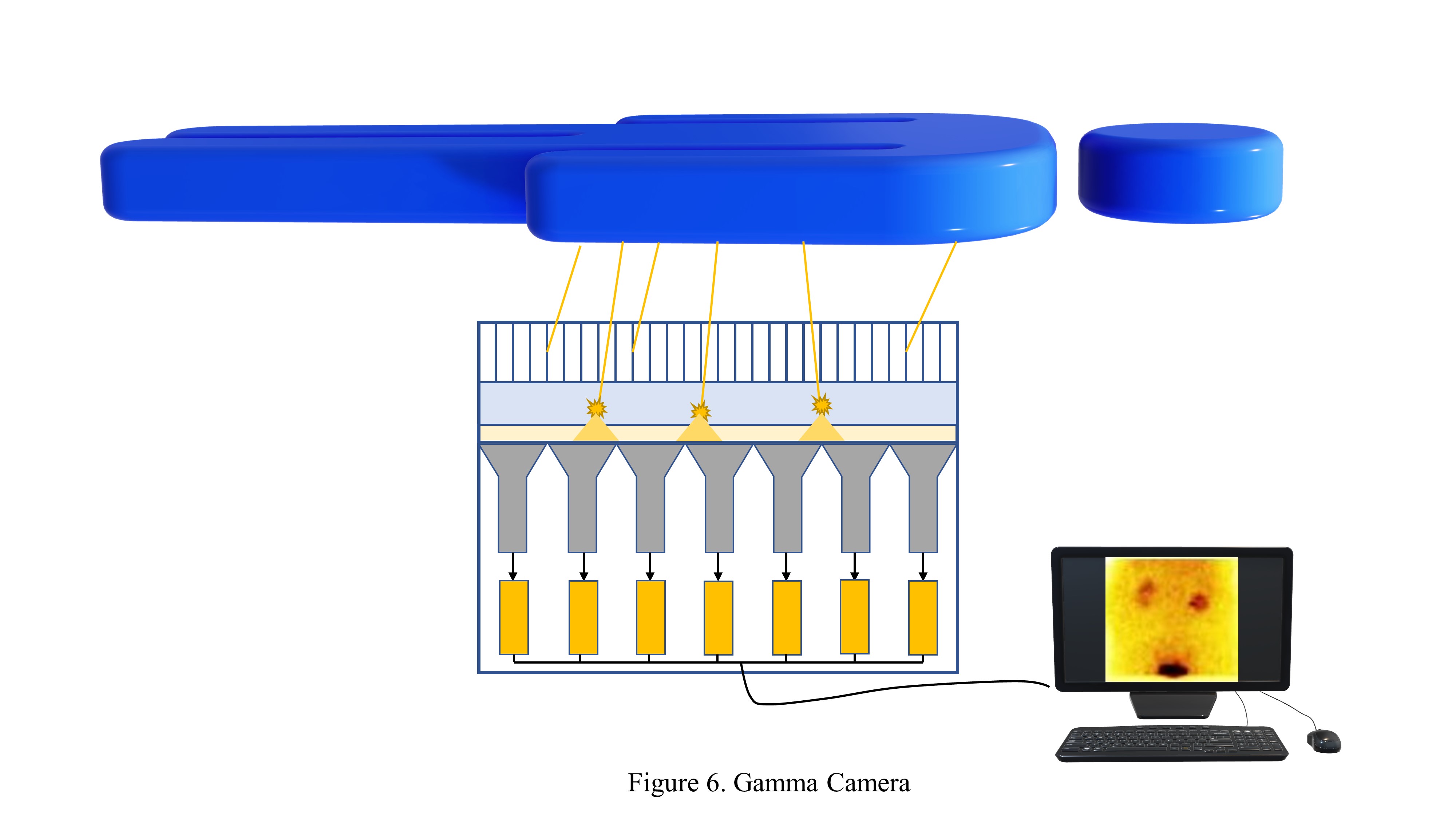 The Gamma Camera