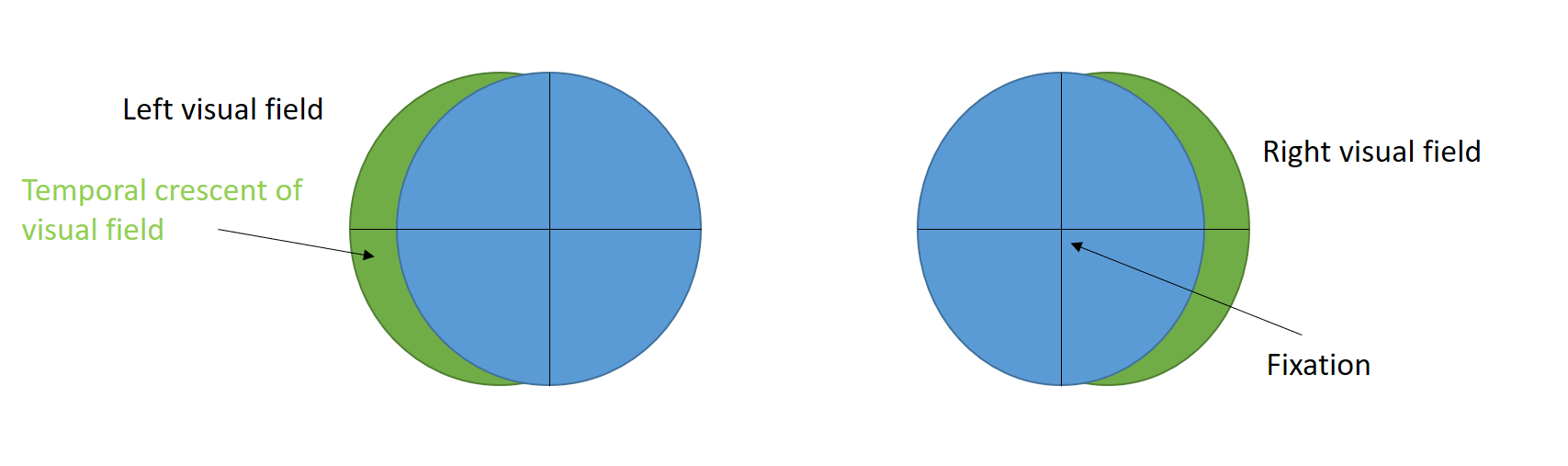 Temporal crescent of visual field