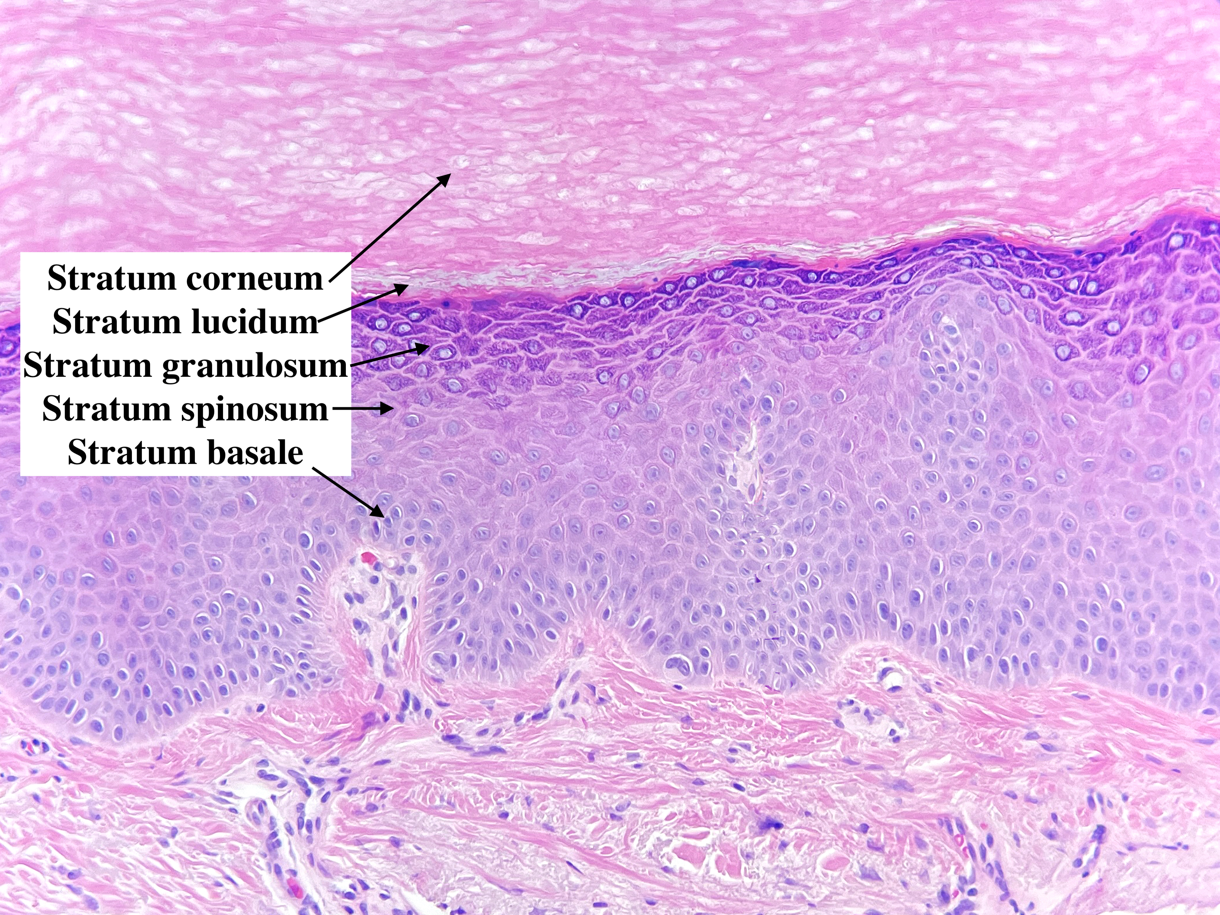 Layers of the epidermis