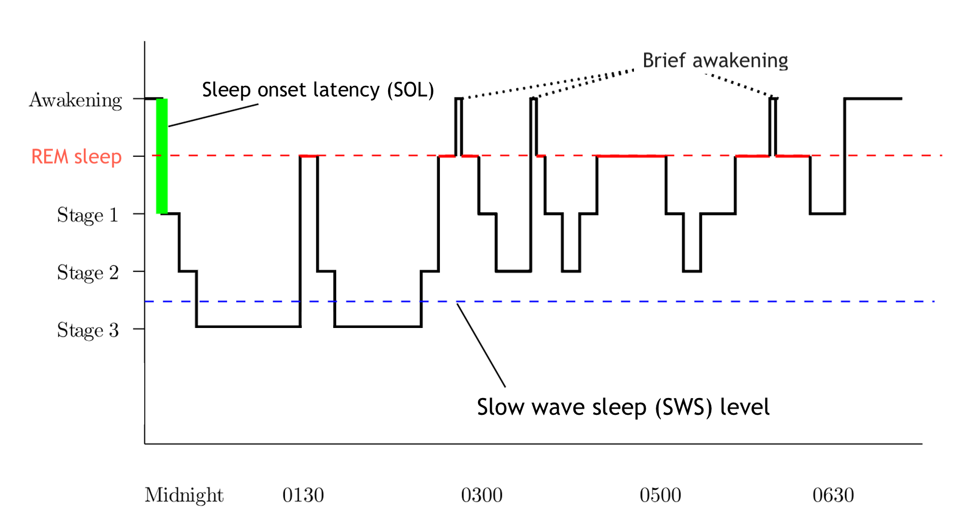 <p>Hypnogram of Sleep Stages and Cycles