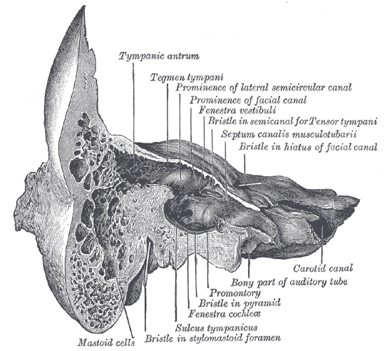 <p>Temporal Bone, Coronal View