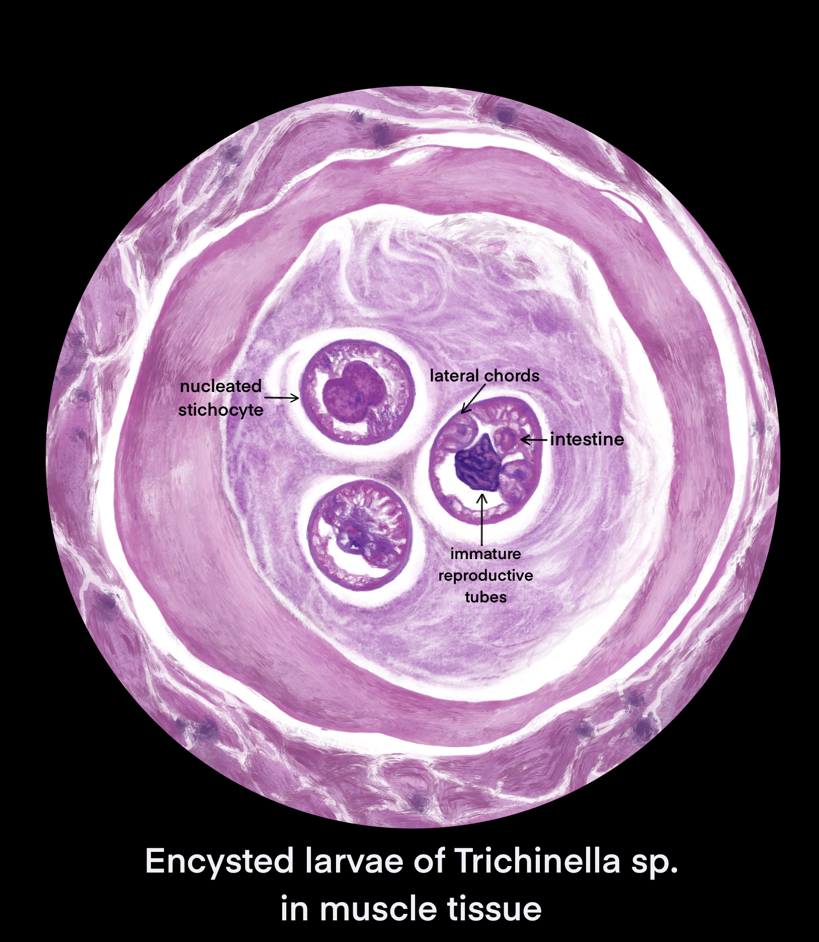 Drawing of encysted Trichinella larvae by Callahan Pels