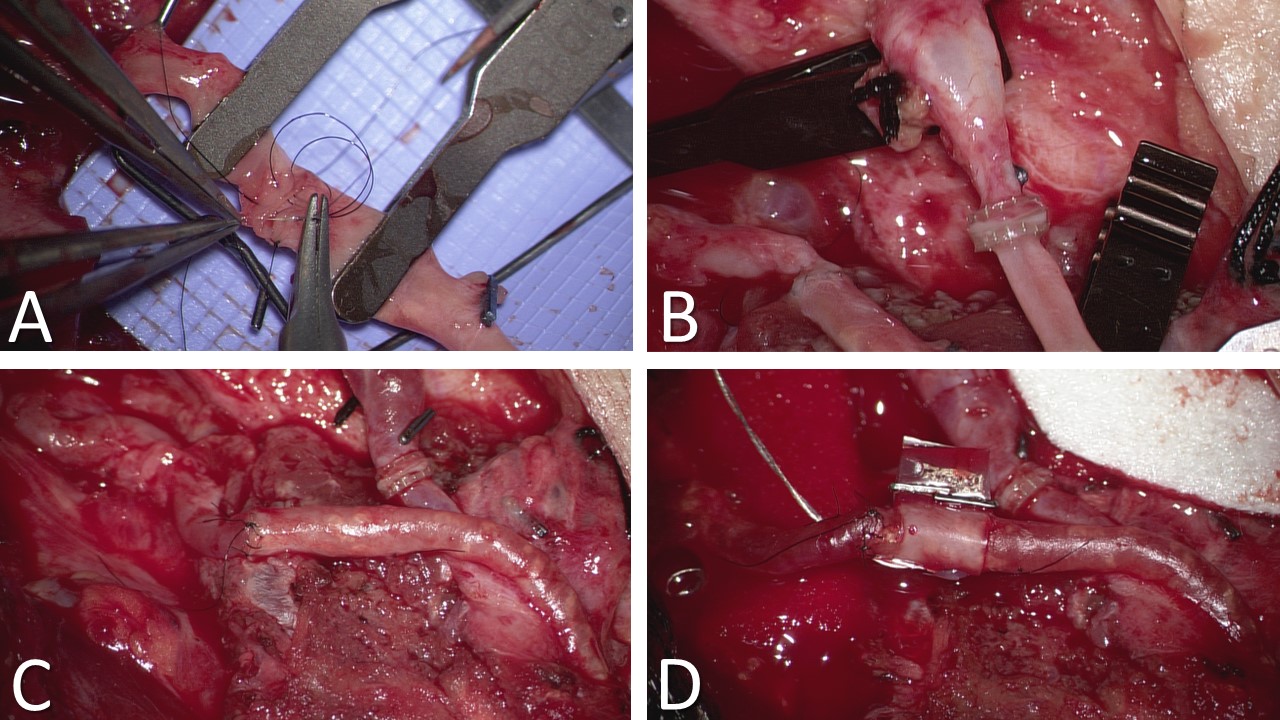 <p>Vascular Anastomoses