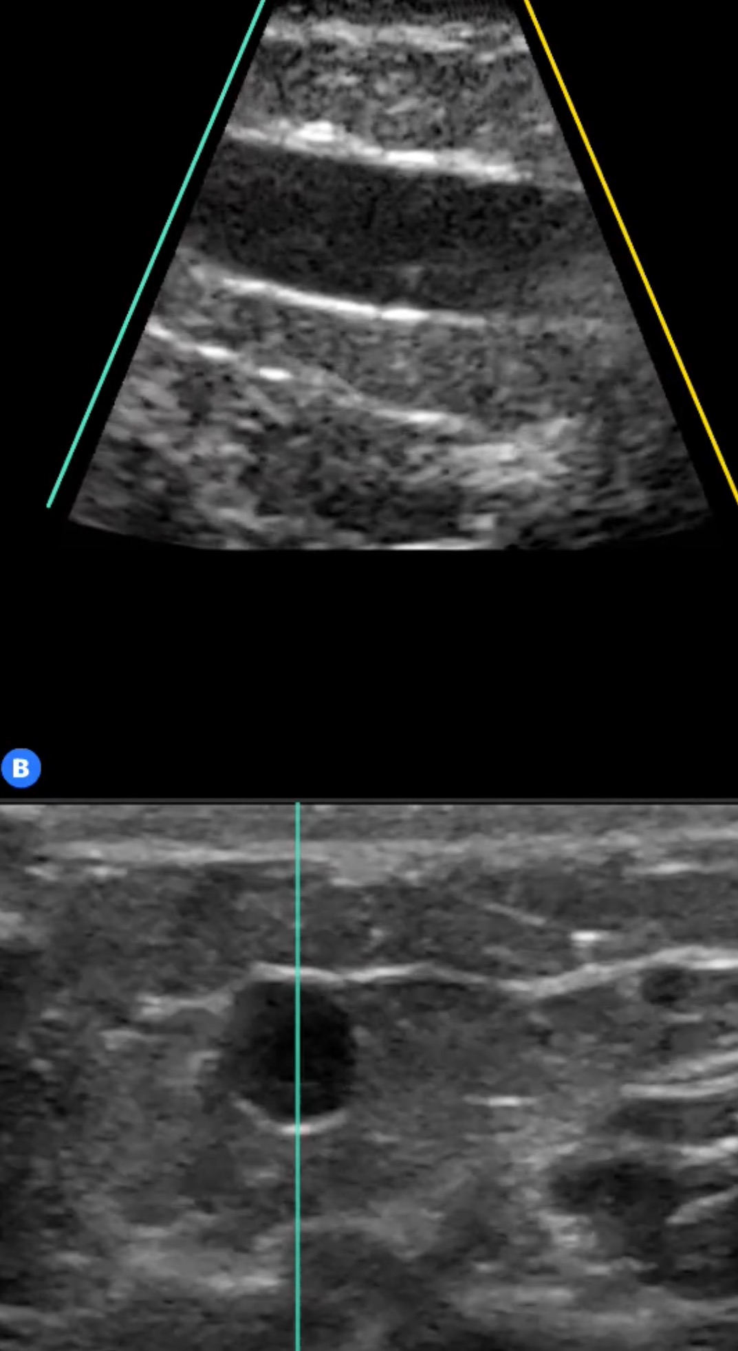 <p>Ultrasound Intravenous Access&nbsp;Multiplanar Views