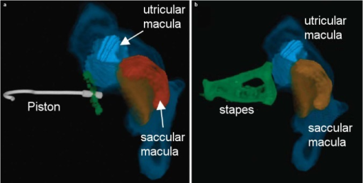 <p>Three-Dimensional Reconstruction of Stapes and Vestibular Structures from Micro&ndash;Computed Tomography