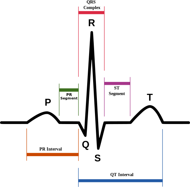 <p>Normal Sinus Rhythm on Electrocardiography