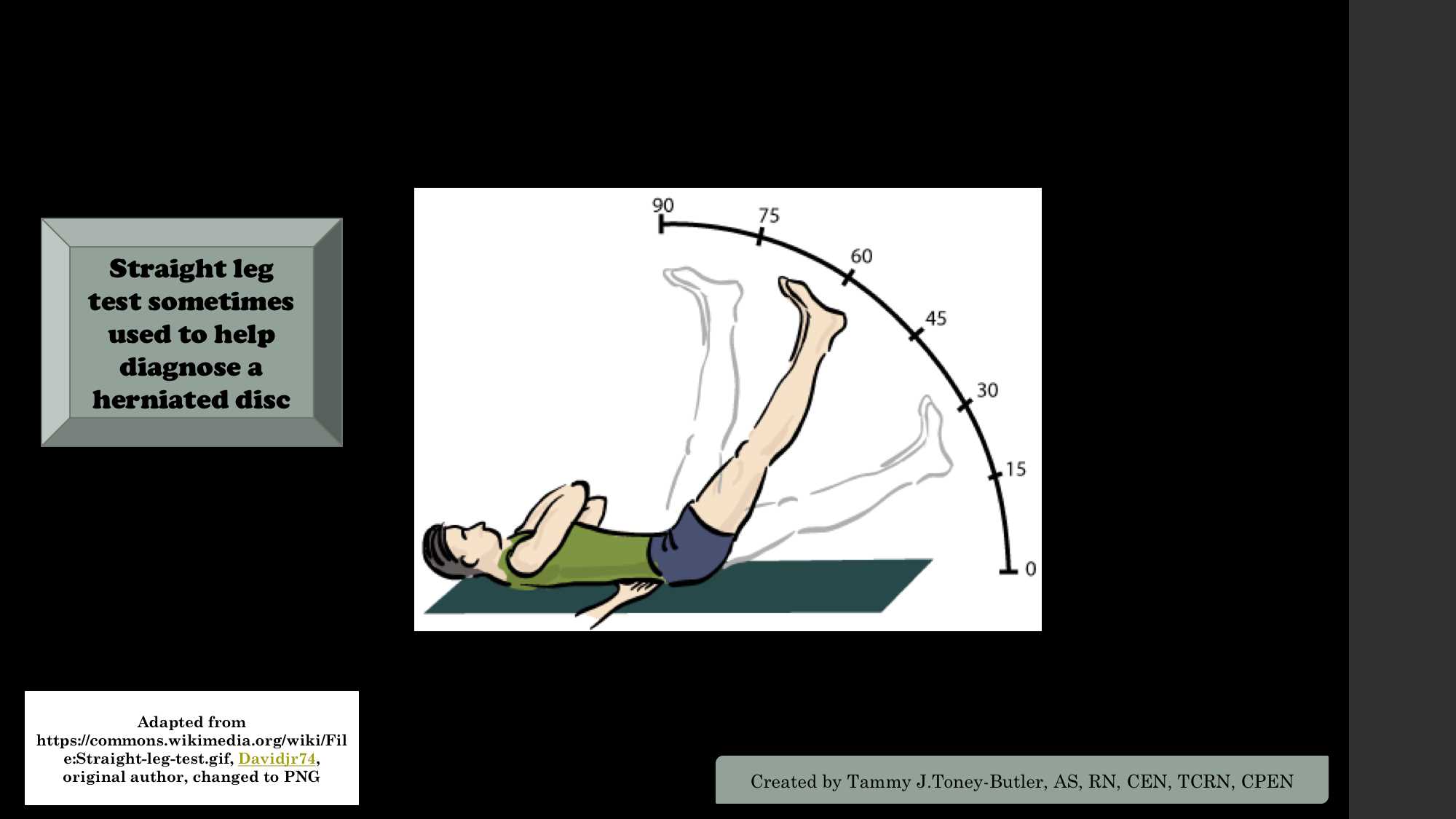 <p>Straight Leg Test. The straight leg test is sometimes used to help diagnose a herniated disc.</p>