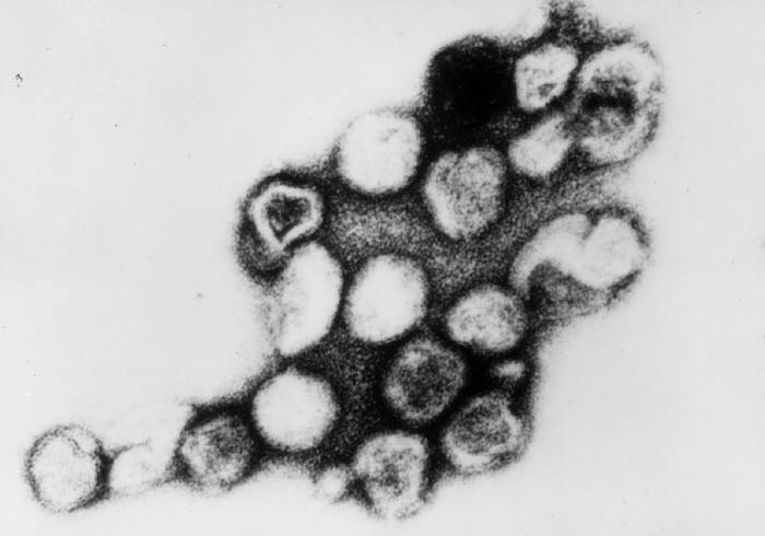 <p>Rubella Virus, Transmission Electron Micrograph