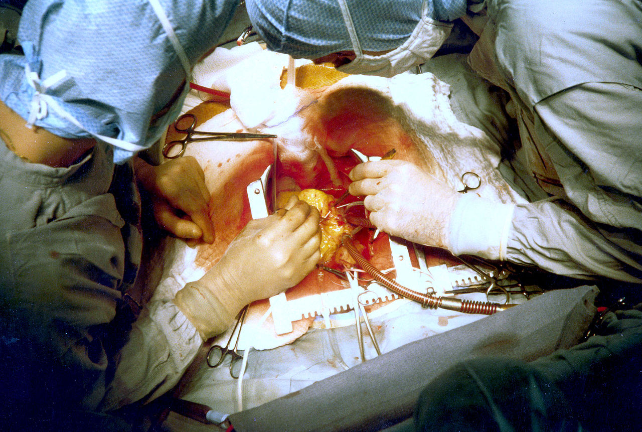 <p>Performing a Coronary Artery Bypass Surgery