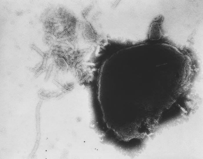 <p>Paramyxovirus Virion, Transmission Electron Micrograph