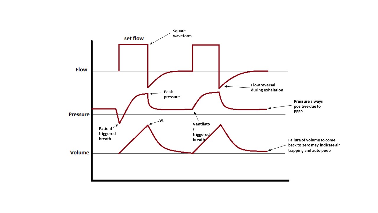 <p>Assist Control Ventilation</p>