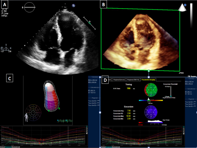 <p>Cardiac Imaging, Echocardiography