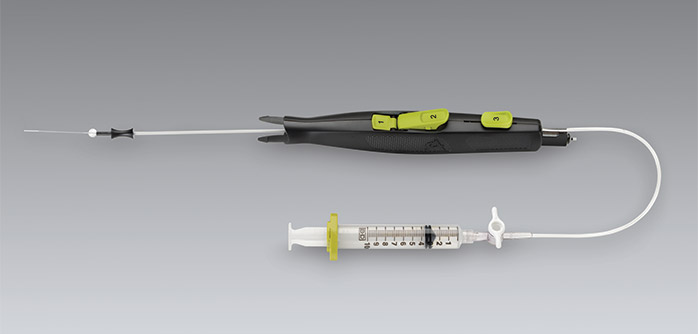 Mynx device provides an extravascular sealant (polyethylene glycol) for vascular access site closure.