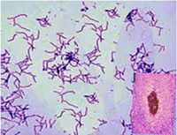 Actinomycosis