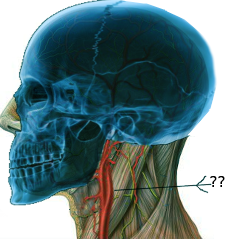 Carotid bifurcation