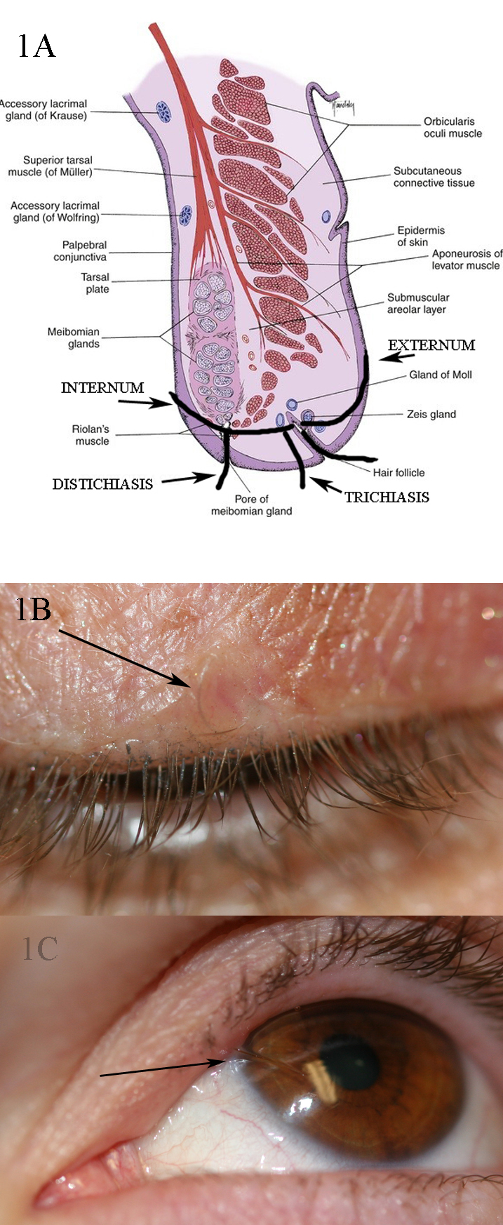 <p>Anatomical Structures, Eyelashes