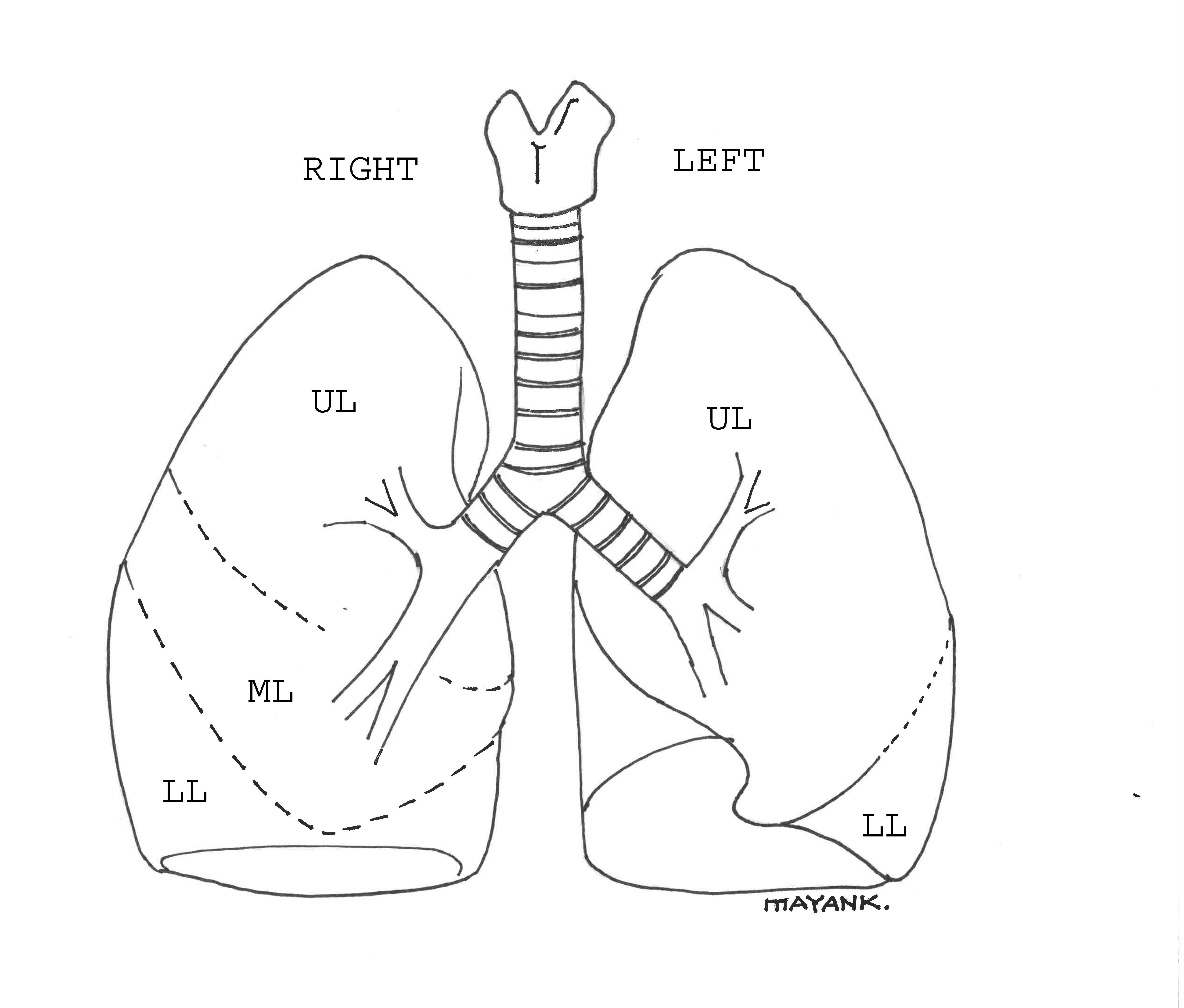 <p>Trachea and Lung Lobes, Illustration. The image describes the anatomy of the lung lobes.</p>