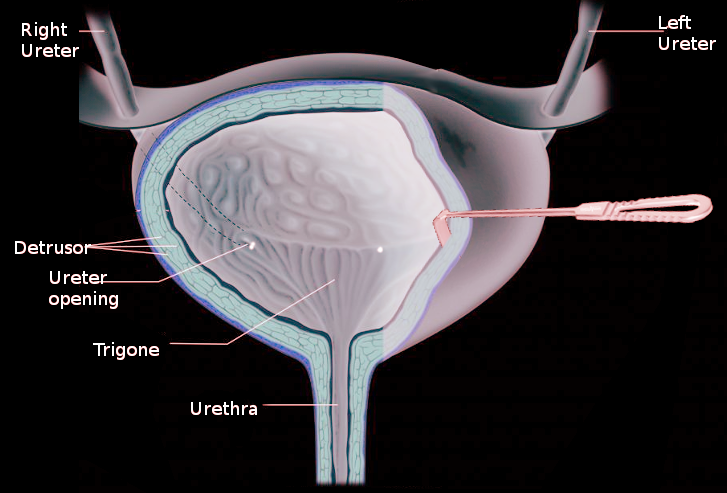 Detrusor muscle