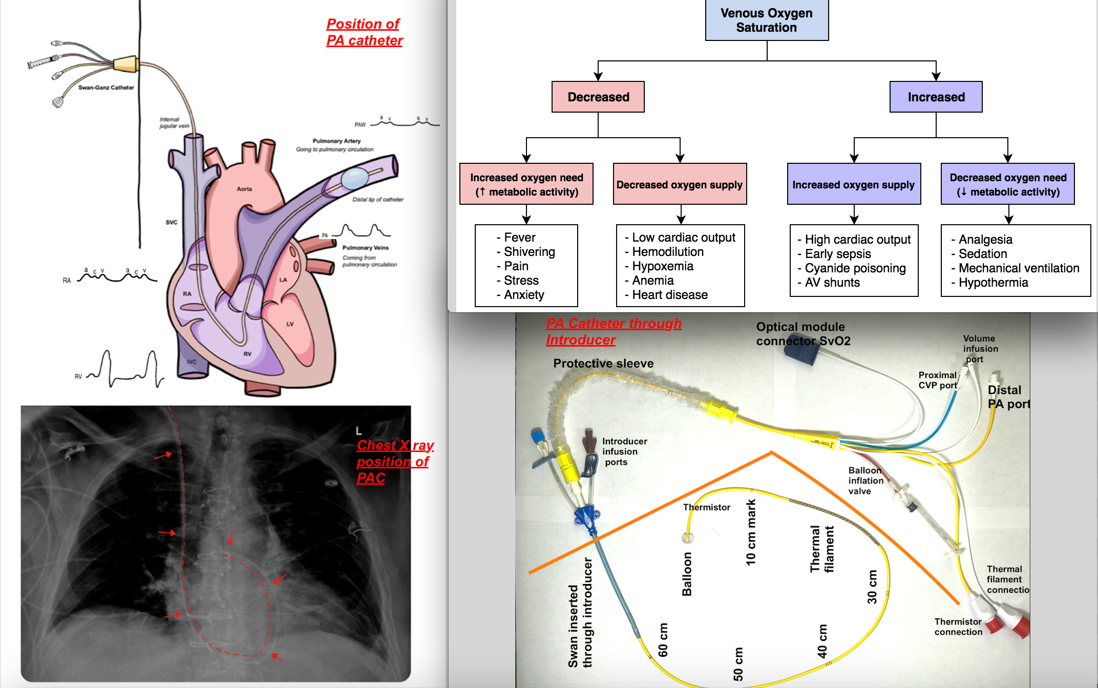 <p>Anesthesia Monitoring